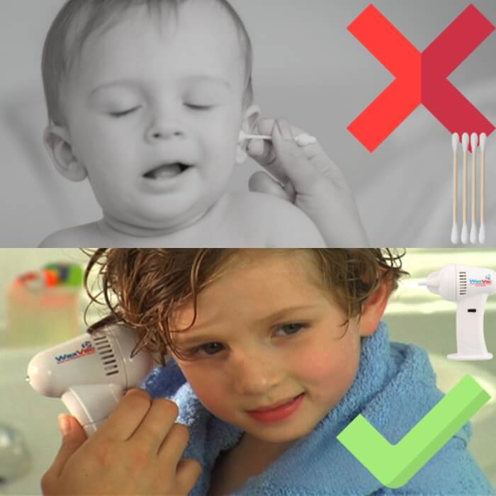 Limpador de ouvidos WaxVac™