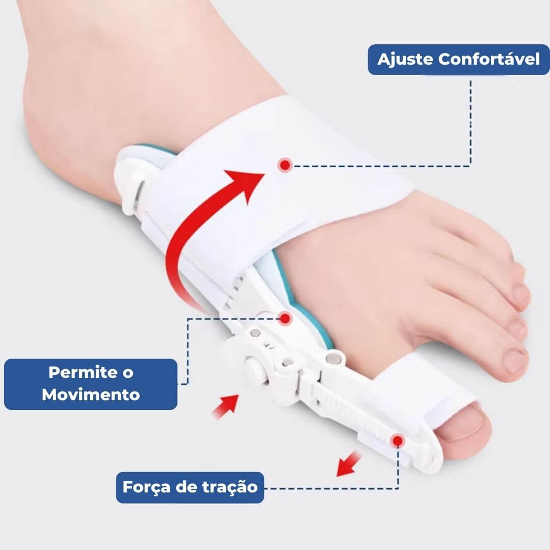 Corretor de Joanetes