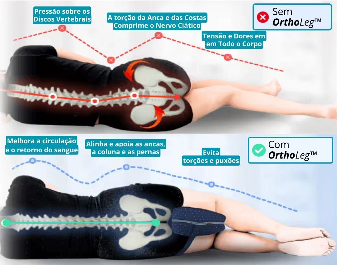 OrthoLeg™ - Almofada Ortopédica Para As Pernas
