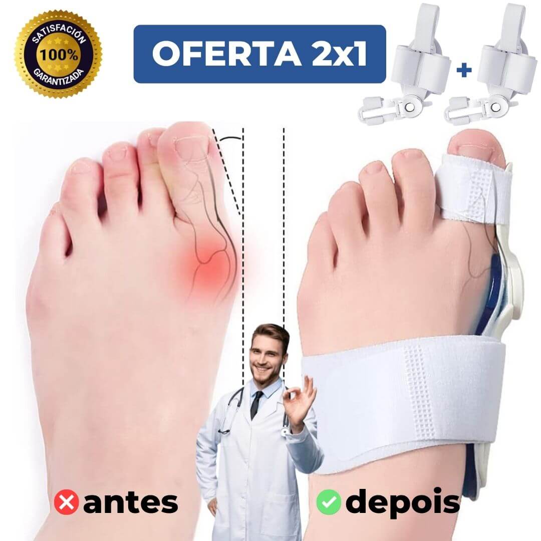 Corretor de Joanetes