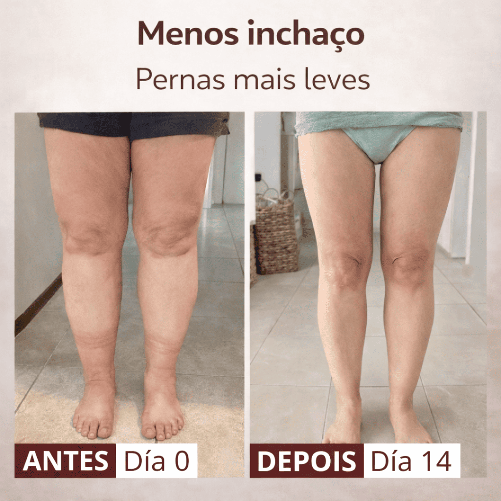Palmilhas de reflexologia FeetComfort™ para pernas inchadas